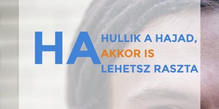Read more about the article Ha hullik a hajad, akkor is lehetsz raszta